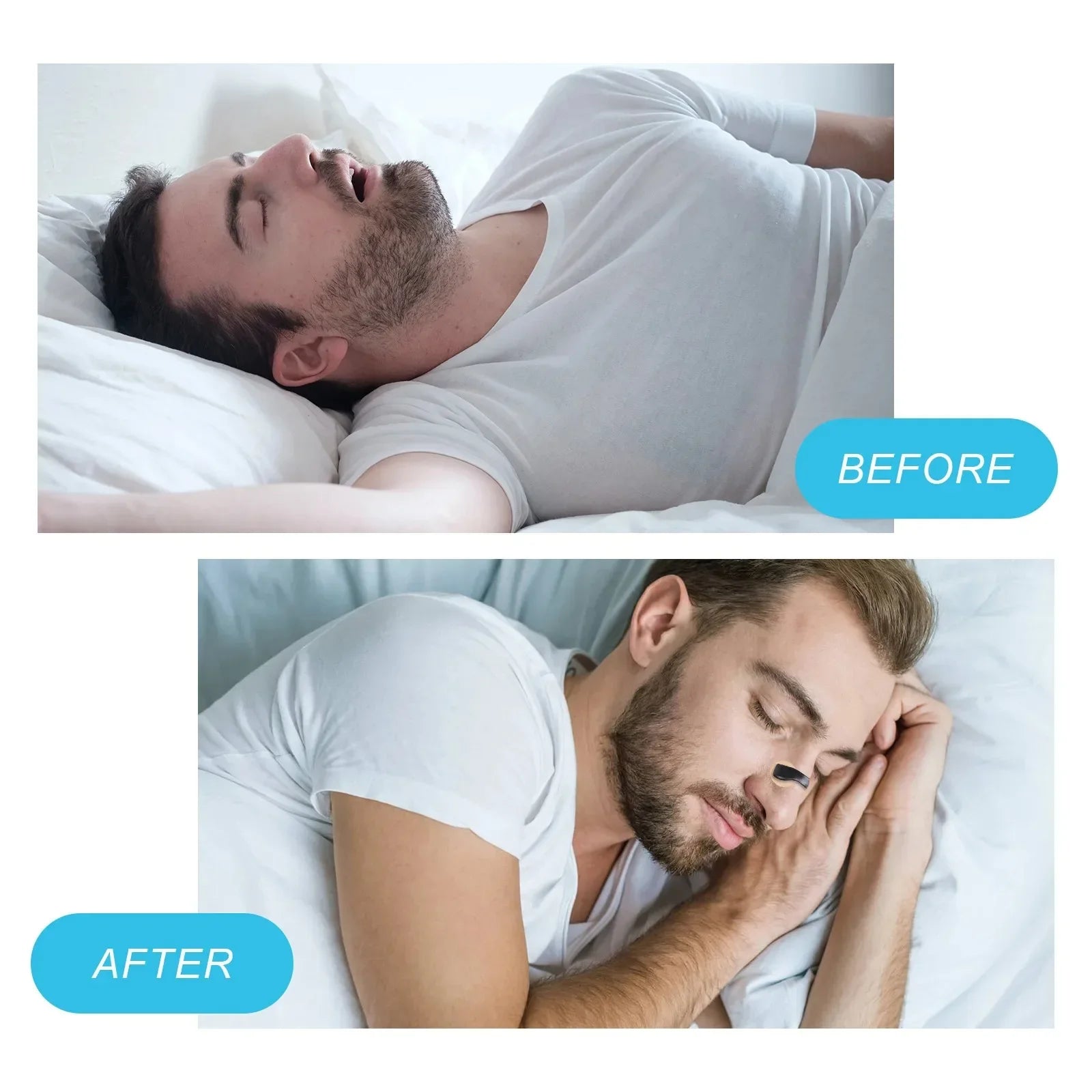 Anti-Snoring Nasal Dilator Starter Kit – Breathe Easier, Sleep Better, Perform Stronger